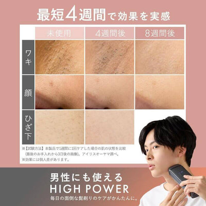 MiCOLA 脈衝光光學除毛儀, AC100-240V LB-M101-W