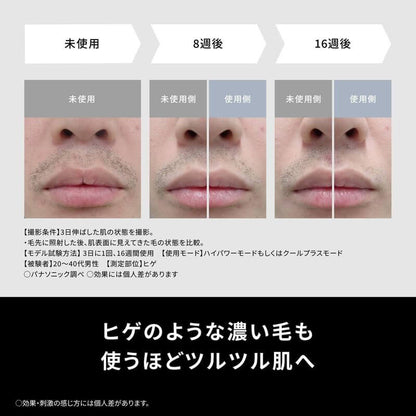 光學除毛儀, 冰鎮冷卻功能, 國際電壓 ES-WG0B-H