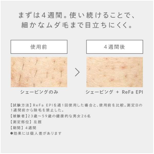 EPI Flash-Style IPL Hair Removal – With Face & VIO Attachments (100V ...